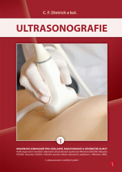 Ultrasonografie